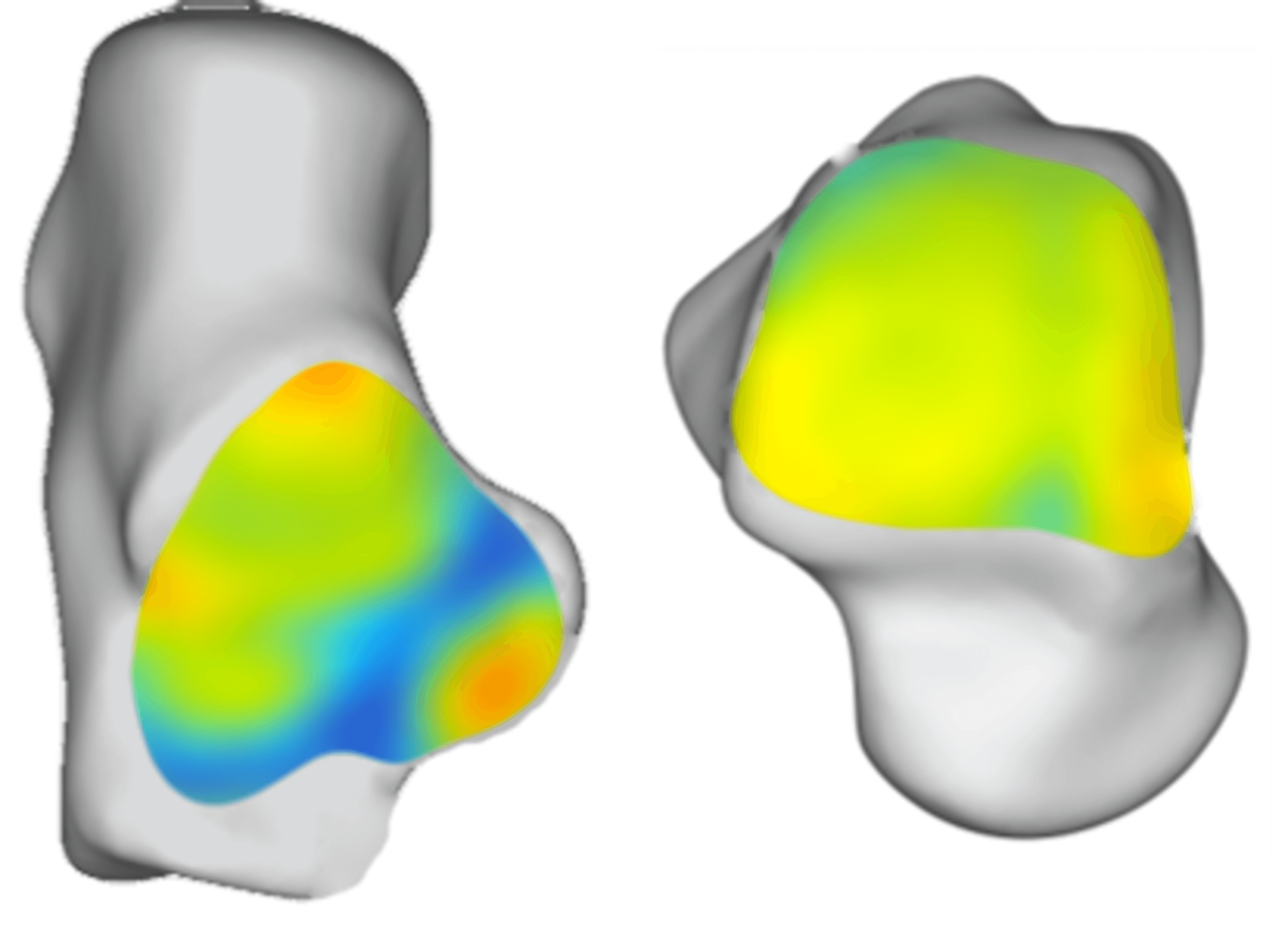 Joint space surface map